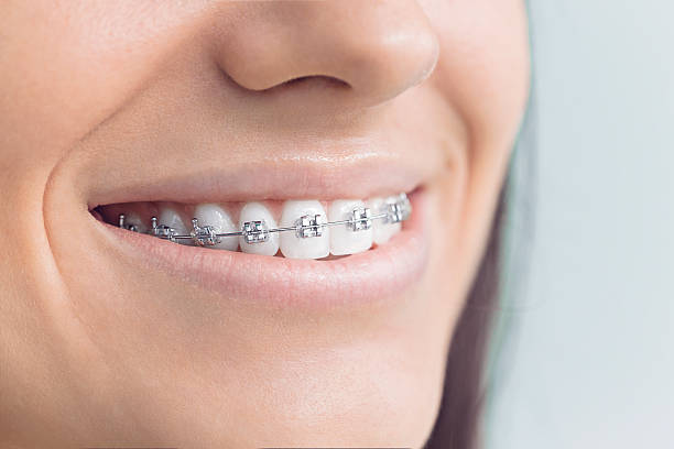 Dental Inlays and Onlays in Newport, VT